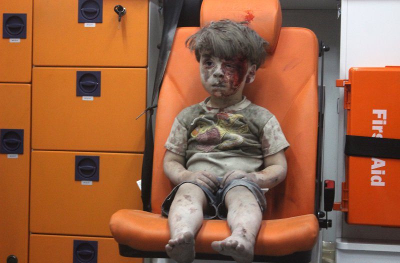ALEPPO, SYRIA - AUGUST 17: (EDITORS NOTE: Image contains graphic content.) 5-year-old wounded Syrian kid Omran Daqneesh sits alone in the back of the ambulance after he got injured during Russian or Assad regime forces air strike targeting the Qaterji neighbourhood of Aleppo on August 17, 2016. (Photo by Mahmud Rslan/Anadolu Agency/Getty Images)