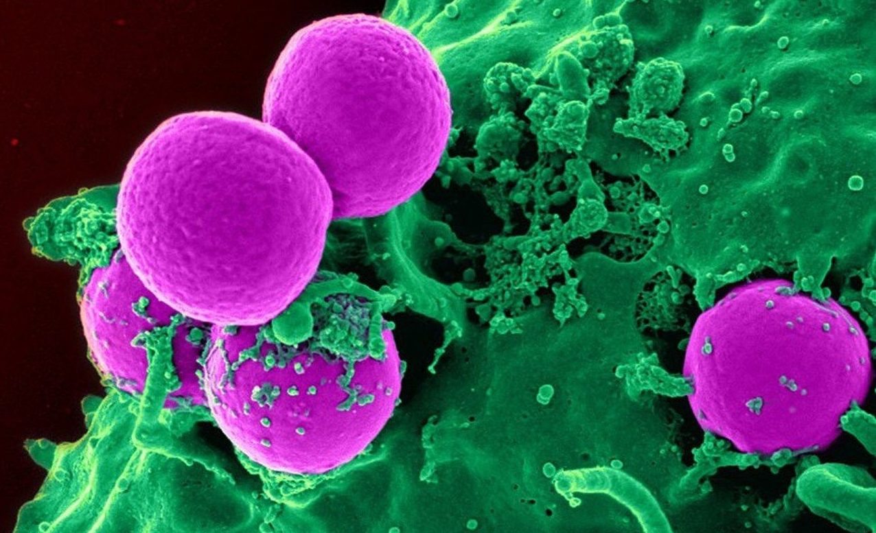 Τα αντιβιοτικά που μας… σκοτώνουν