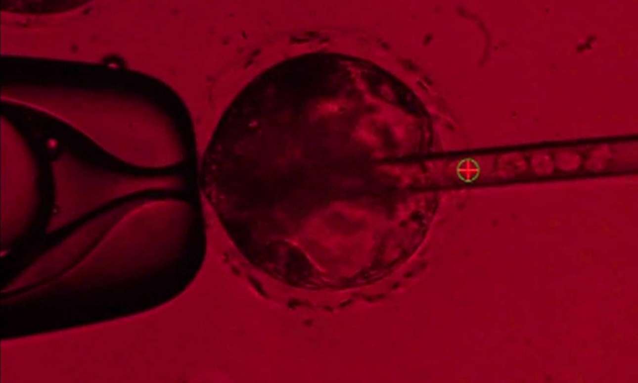 Ανθρώπινα όργανα καλλιεργούνται σε χοίρους