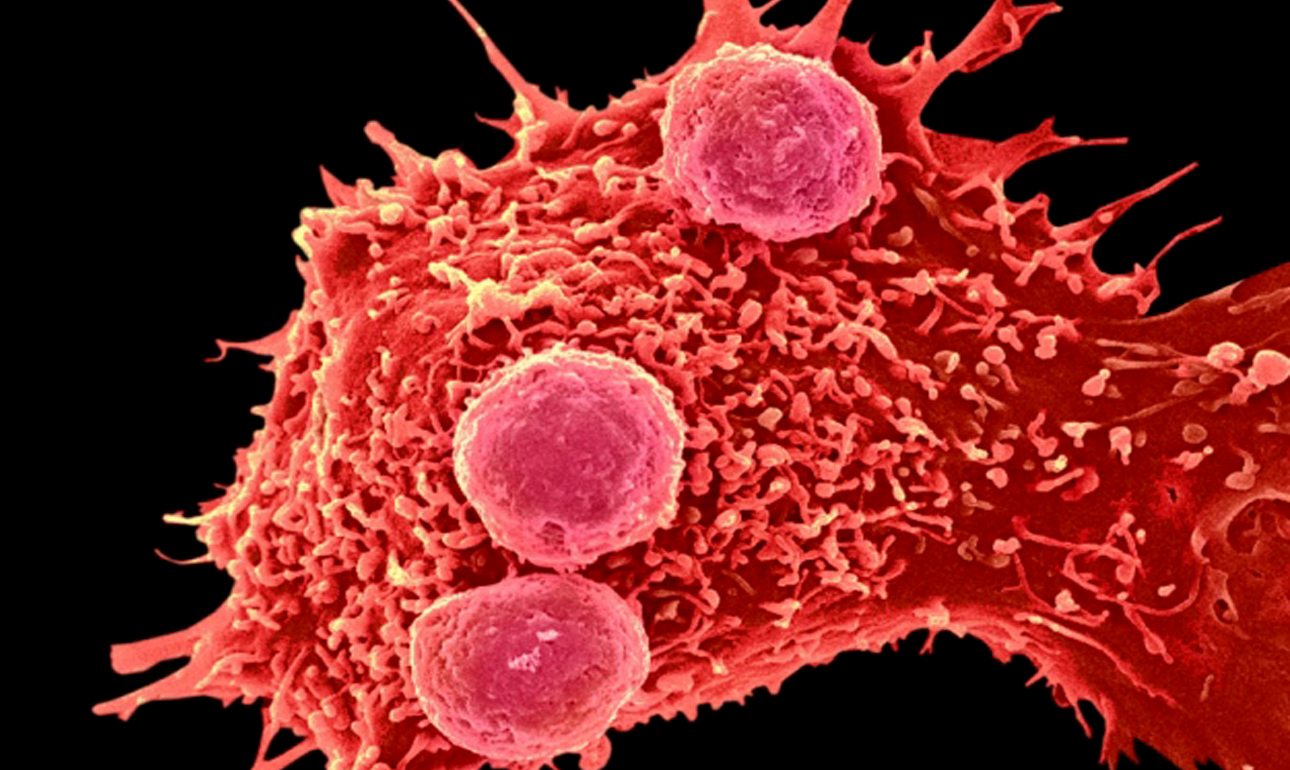 Βρέθηκε (;) το «άγιο δισκοπότηρο» της Γενετικής