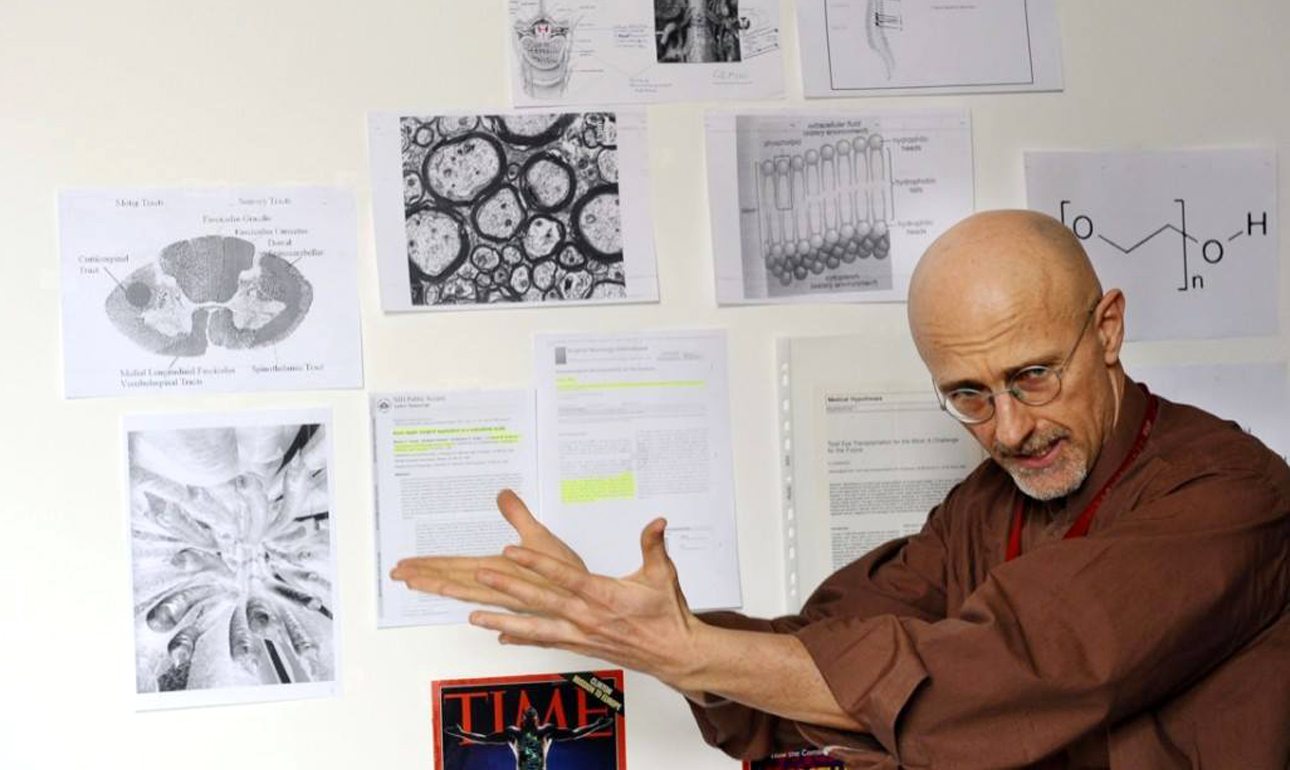 Μοντέρνος Φρανκενστάιν: Θέλει να μεταμοσχεύσει κεφάλι σε άνθρωπο!