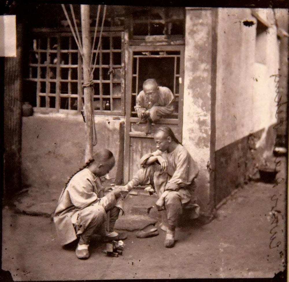 Ενας γιατρός εξετάζει το πόδι ασθενή στους δρόμους του Πεκίνου, το 1869