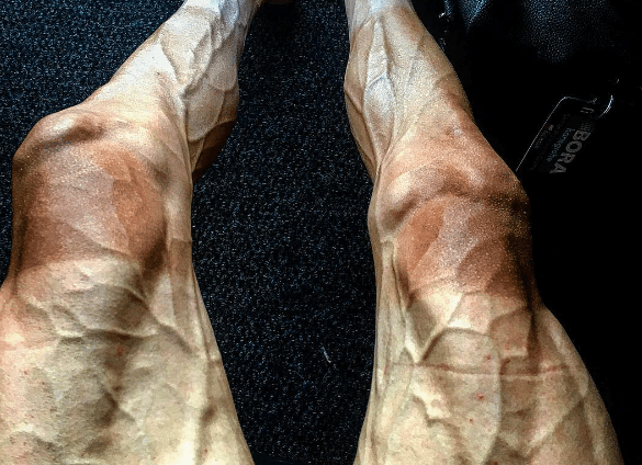 Πώς είναι πραγματικά τα πόδια ενός ποδηλάτη που κάνει τον γύρο της Γαλλίας