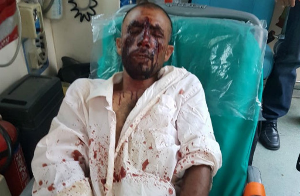 Το θύμα της ρατσιστικής επίθεσης στον Ασπρόπυργο αναγνώρισε δύο δράστες