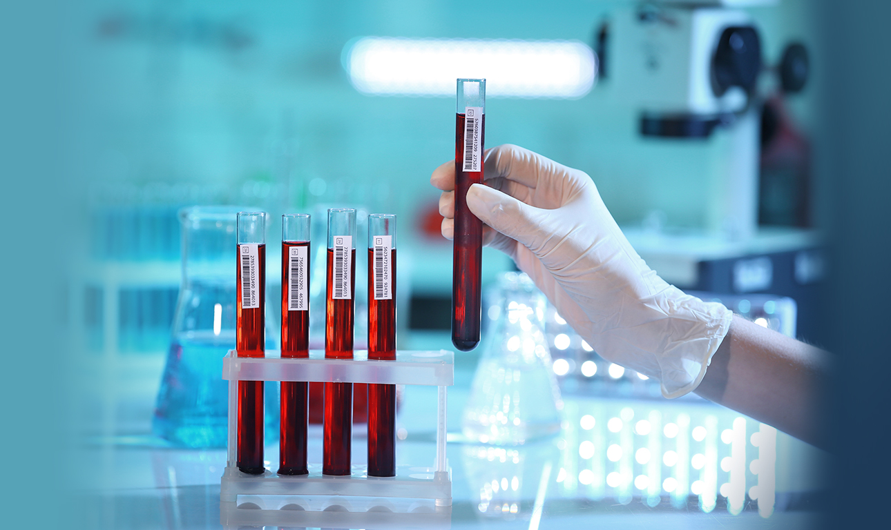 Νέα εξέταση αίματος δείχνει-λένε- πόσο θα ζήσουμε!