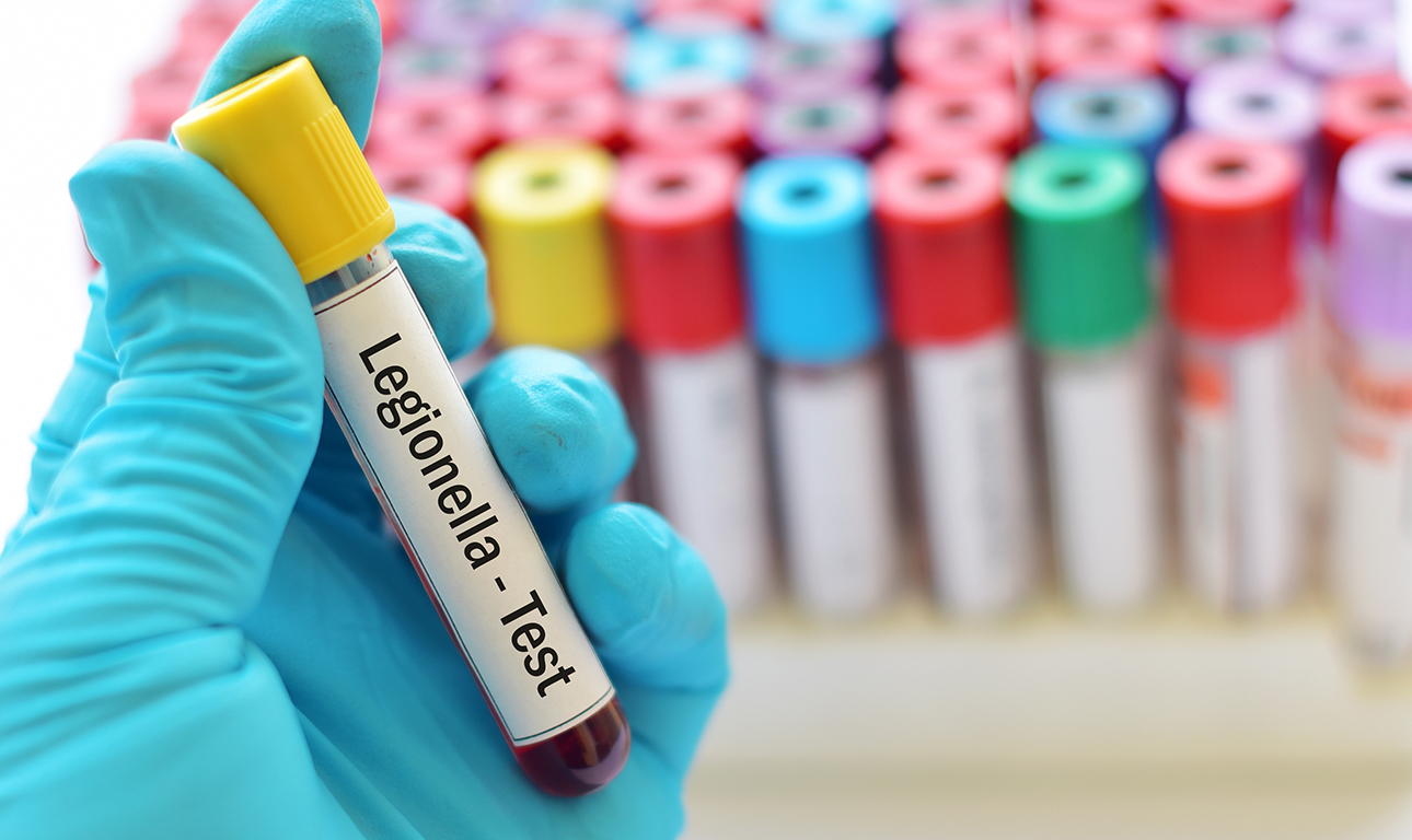 Συναγερμός: Οταν η νόσος των λεγεωνάριων μολύνει τα προάστια του Μιλάνου