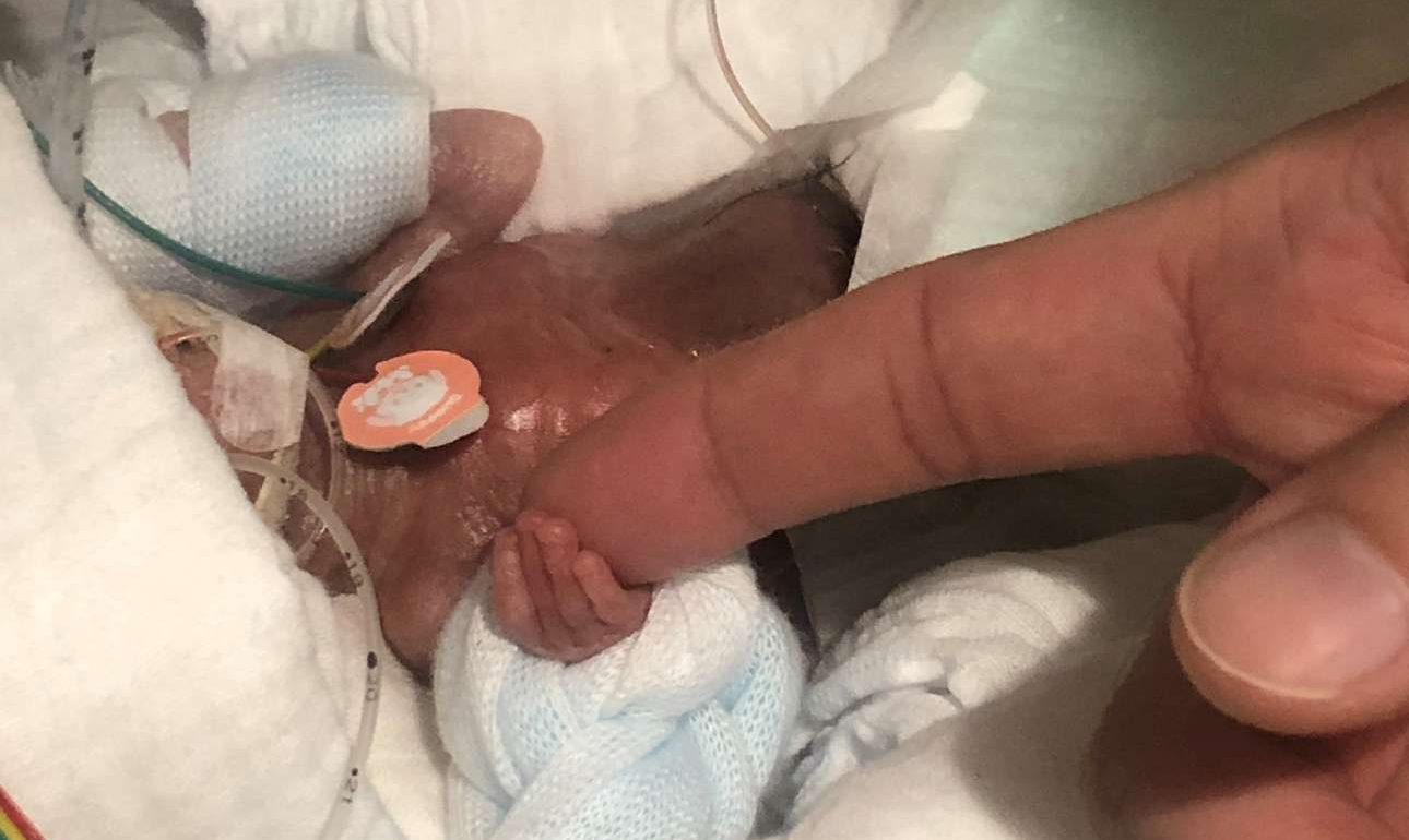 Εξιτήριο πήρε το μικρότερο μωρό που γεννήθηκε ποτέ – Ηταν μόλις 268 γραμμάρια!