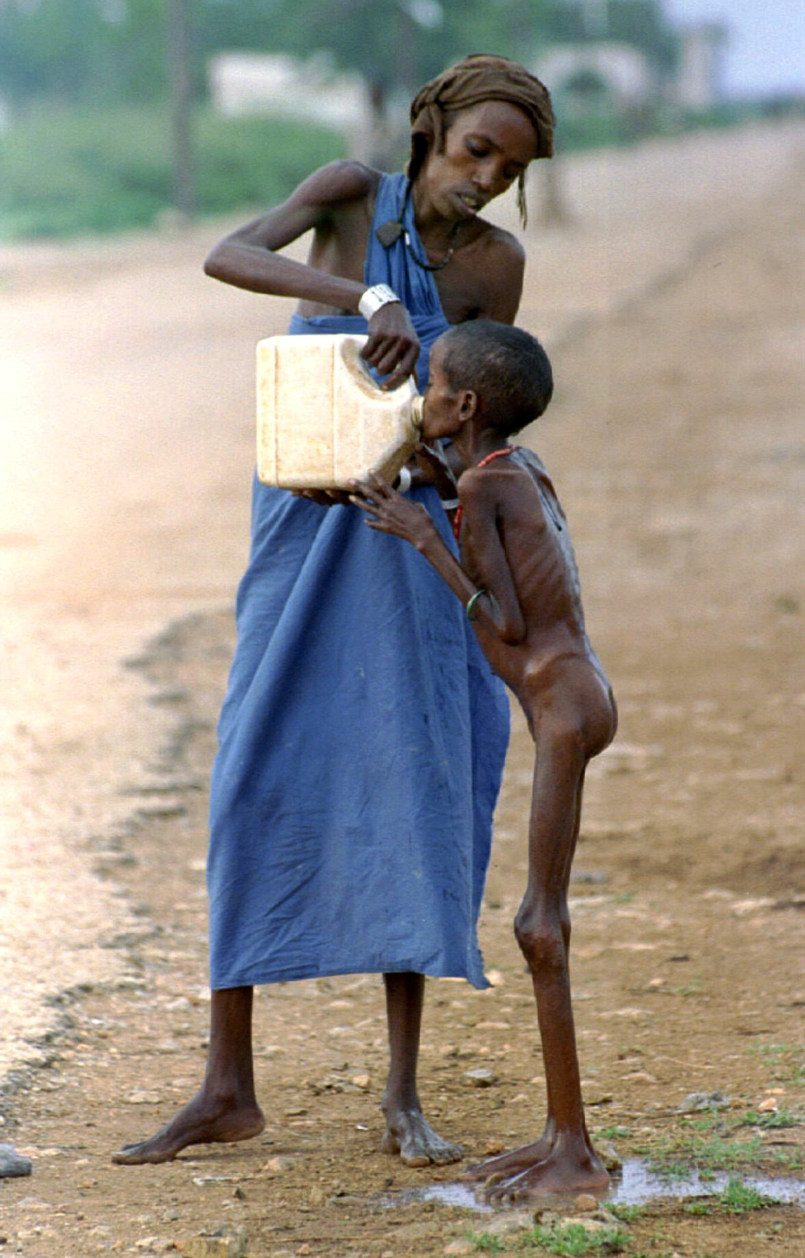Μια γουλιά νερό για το σκελετωμένο παιδί στη Σομαλία το 1992