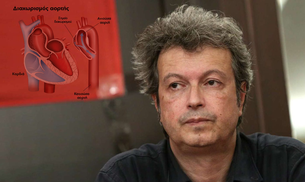 Αυτή είναι η ύπουλη πάθηση που «χτύπησε» την καρδιά του Τατσόπουλου