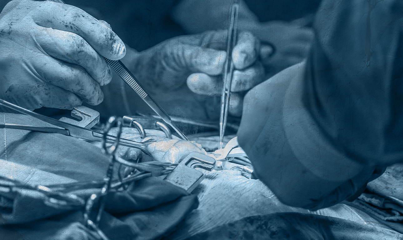 Καρδιοχειρουργική & Covid-19