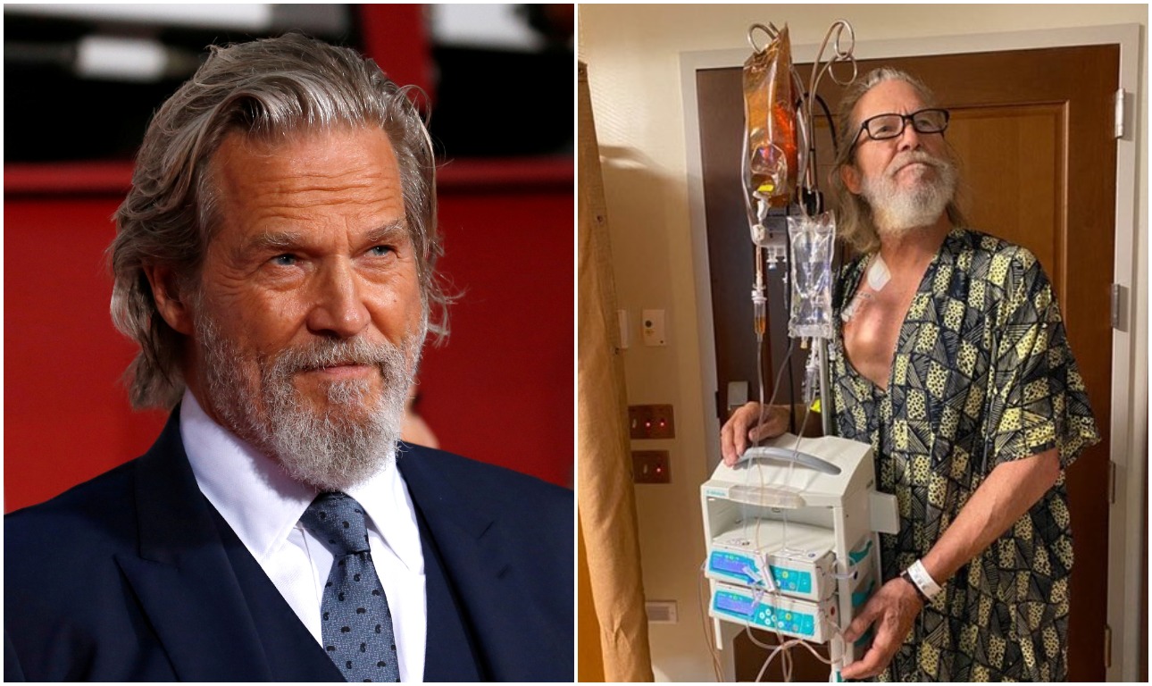 Ο «Dude» δεν το βάζει κάτω: το μήνυμα του Τζεφ Μπρίτζες για τη χημειοθεραπεία