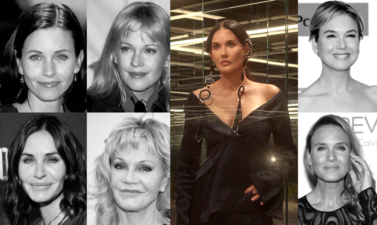 Τι έπαθε το πρόσωπο της Ντέμι Μουρ;