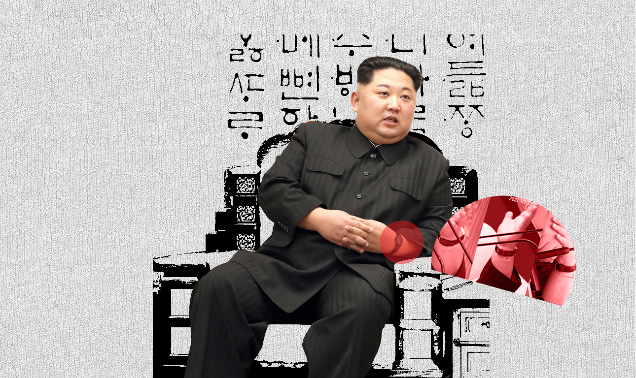 Eίναι άρρωστος ή κάνει δίαιτα; Το αίνιγμα με τον Κιμ