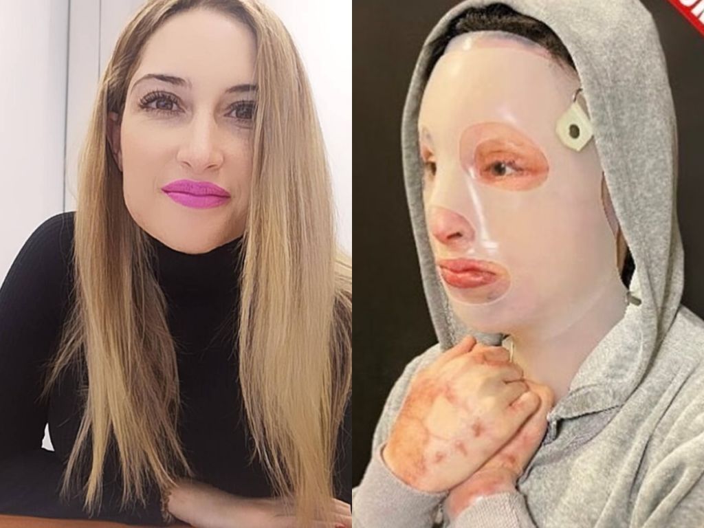 Ξέσπασε η Ιωάννα για το βιτριόλι στη Μονή Πετράκη: Εναν χρόνο μετά την Καλλιθέα δεν άλλαξε τίποτα