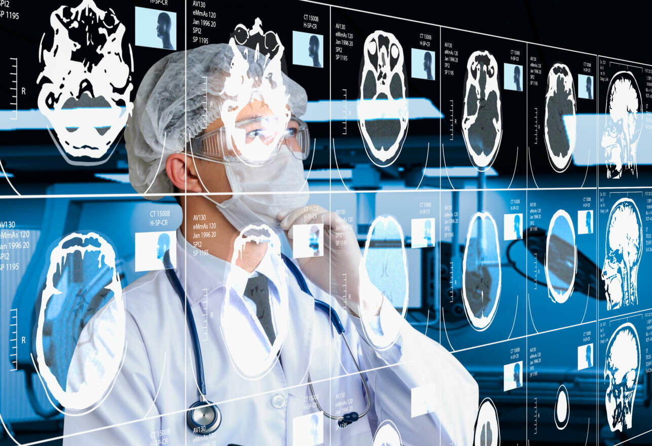 Τεχνητή νοημοσύνη εναντίον άνοιας