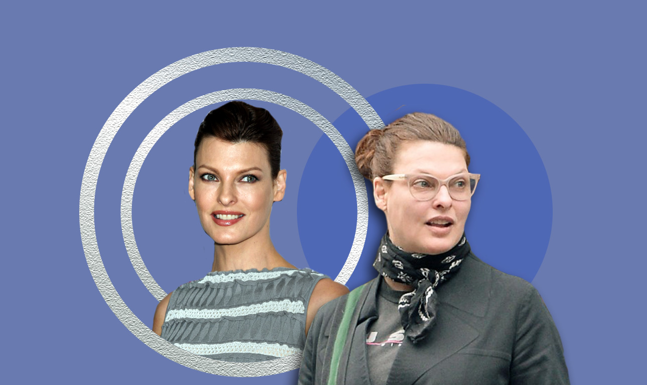 Λίντα Εβαντζελίστα, σούπερ μόντελ: «Mε παραμόρφωσε μια πλαστική»