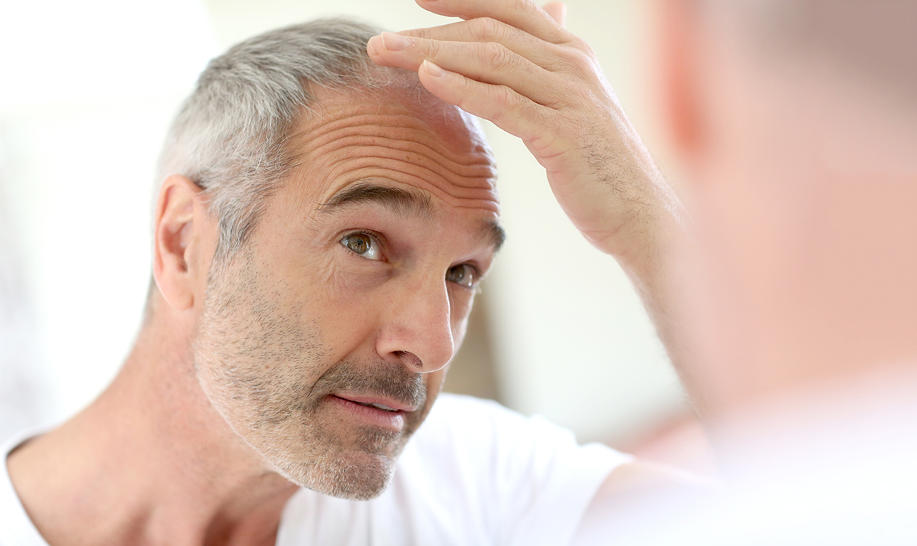 Τριχόπτωση: Οταν ο οργανισμός σταματά να παράγει… ανταλλακτικά