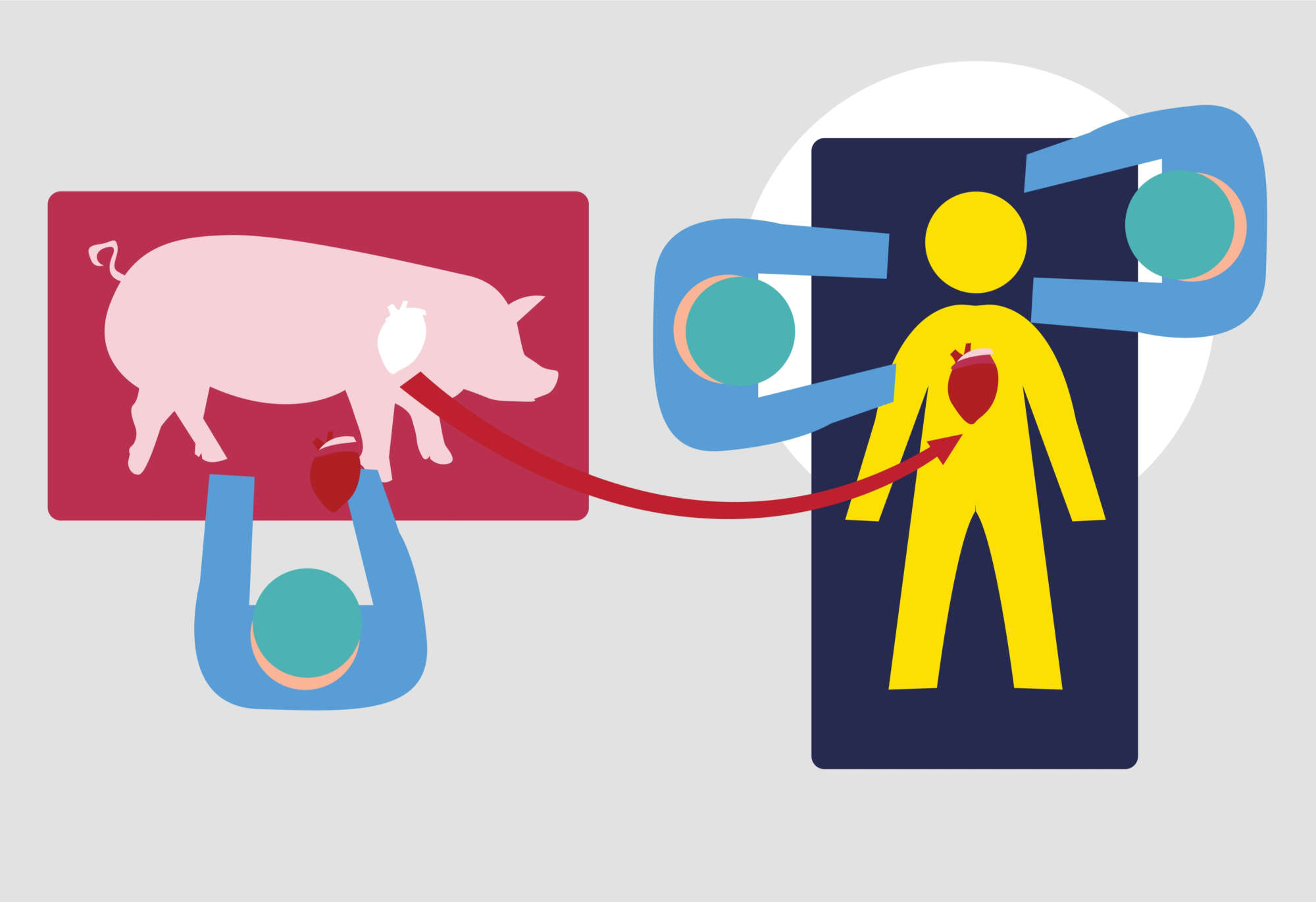 Μεταμοσχεύσεις: Ανοίγει δρόμους η… καρδιά του χοίρου;