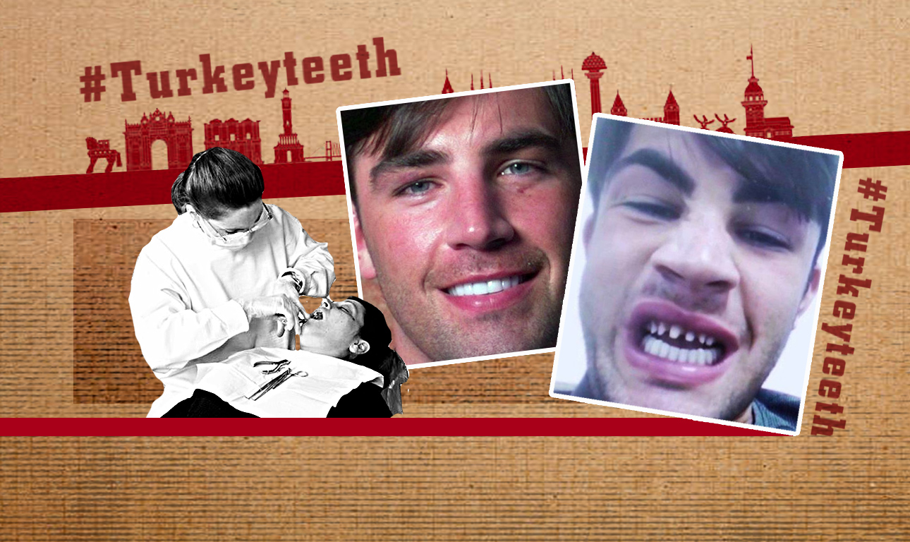 «Δόντια Τουρκίας» ή το κυνήγι της «τέλειας» οδοντοστοιχίας