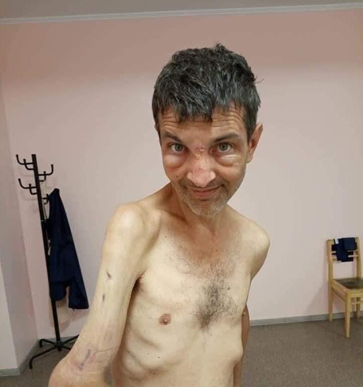 Συγκλονιστικές φωτογραφίες ουκρανού στρατιώτη μετά την αιχμαλωσία του