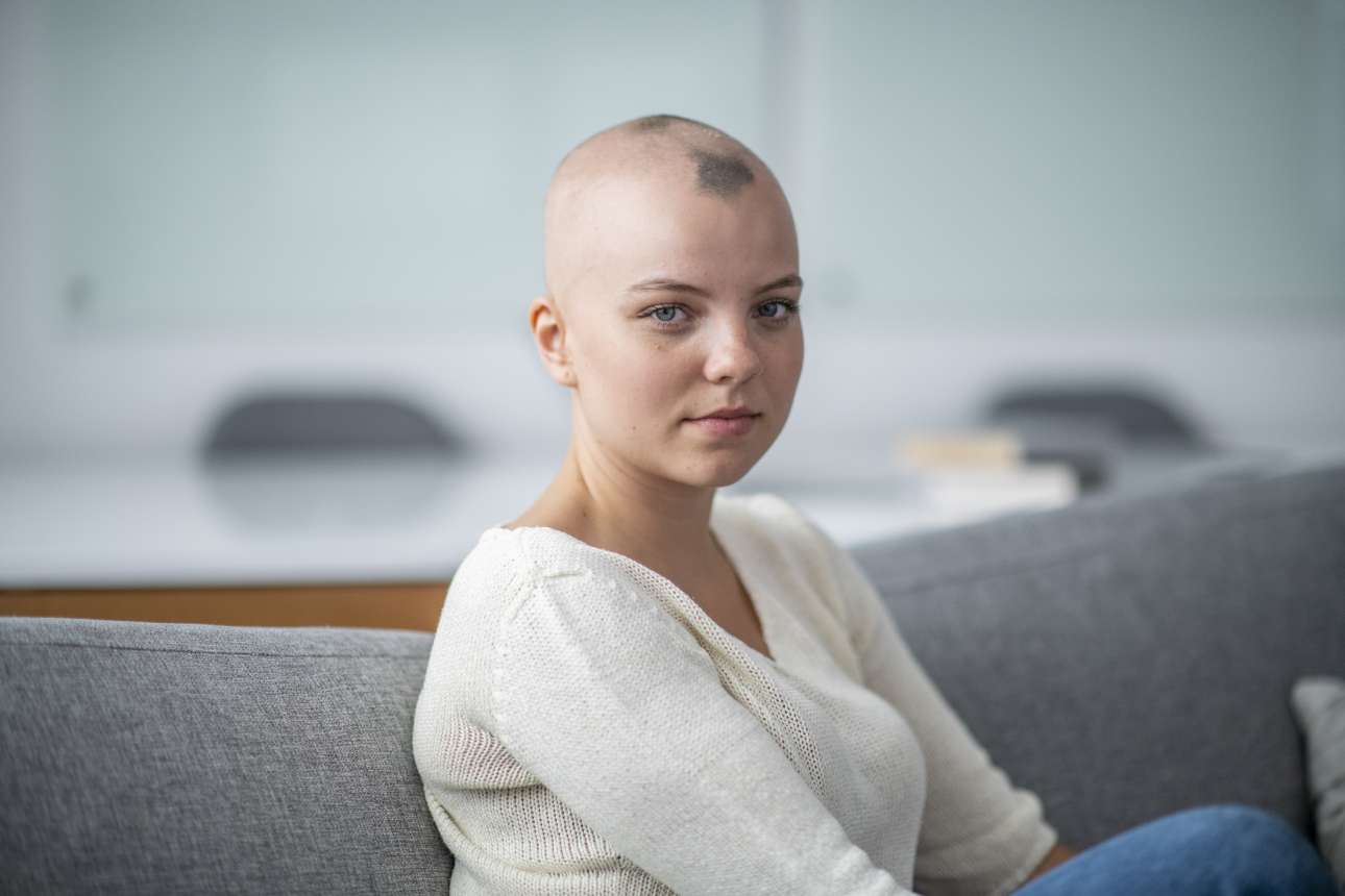 Γυροειδής αλωπεκία: Υπάρχουν λύσεις