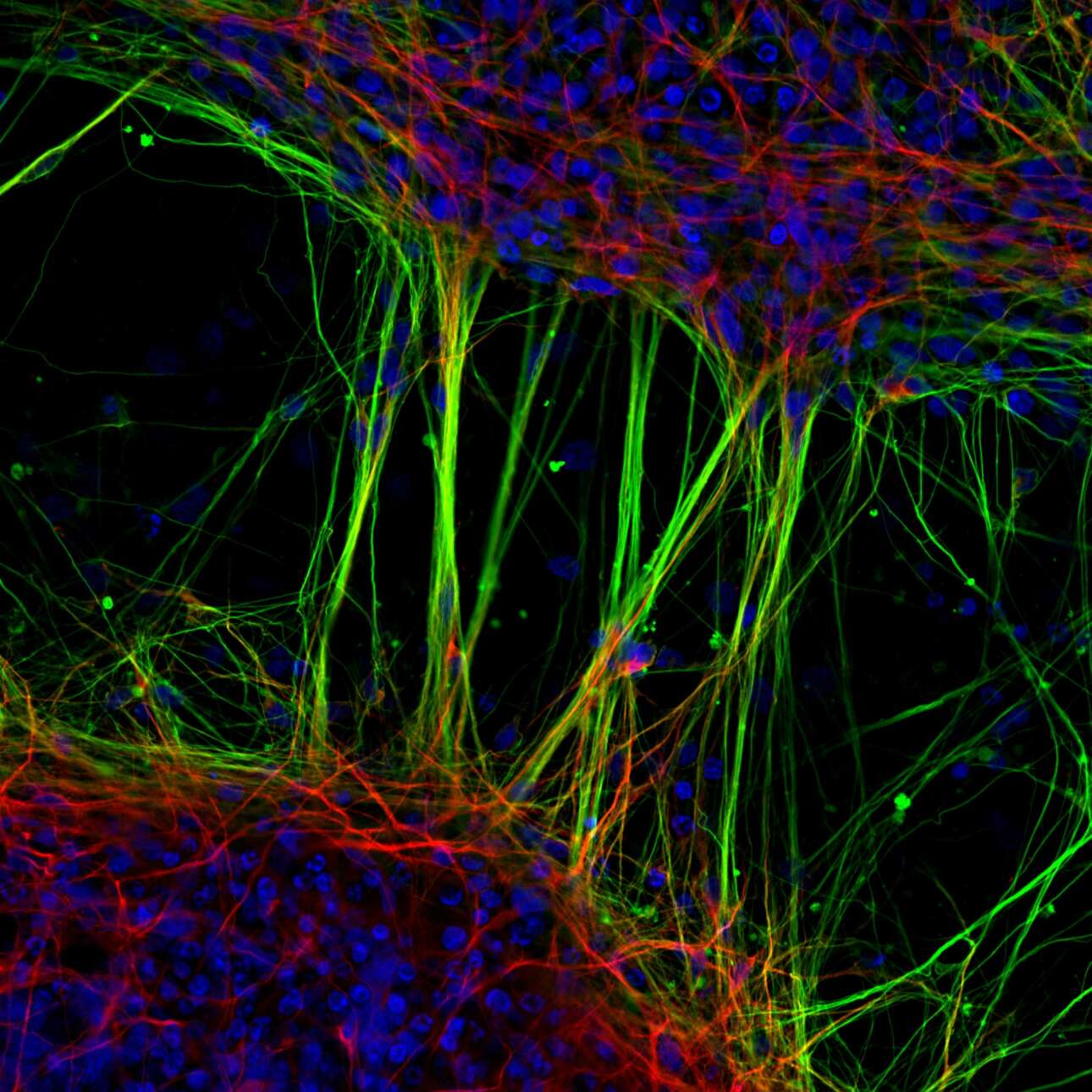 Ανθρώπινοι νευρώνες που προέρχονται από νευρικά βλαστοκύτταρα