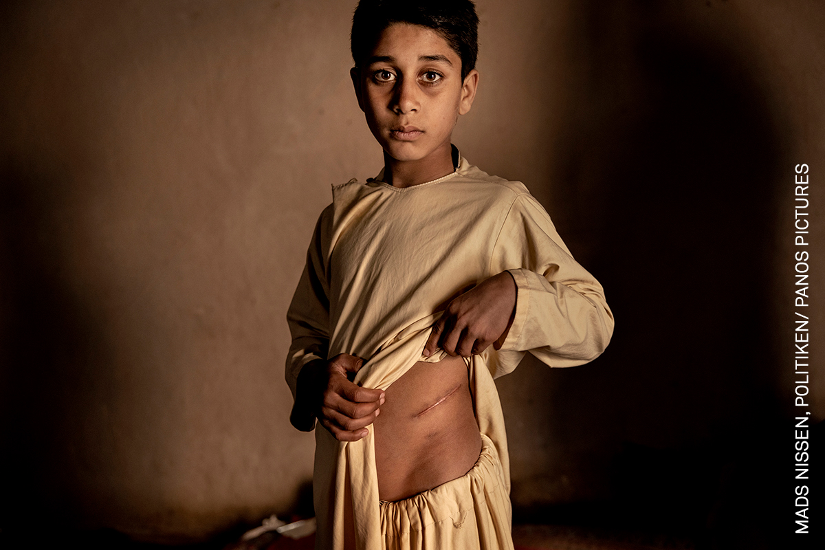 World Press Photo, Ιστορία της Χρονιάς: Το τίμημα της ειρήνης στο Αφγανιστάν. Αδυνατώντας να αγοράσουν φαγητό, οι γονείς του 15χρονου Καλίλ Αχμάντ αποφάσισαν να πουλήσουν το νεφρό του για 3.500 δολάρια (3.175 ευρώ). Η έλλειψη θέσεων εργασίας και η απειλή της πείνας έχουν οδηγήσει σε δραματική αύξηση του παράνομου εμπορίου οργάνων. Χεράτ, Αφγανιστάν, 19 Ιανουαρίου 2022