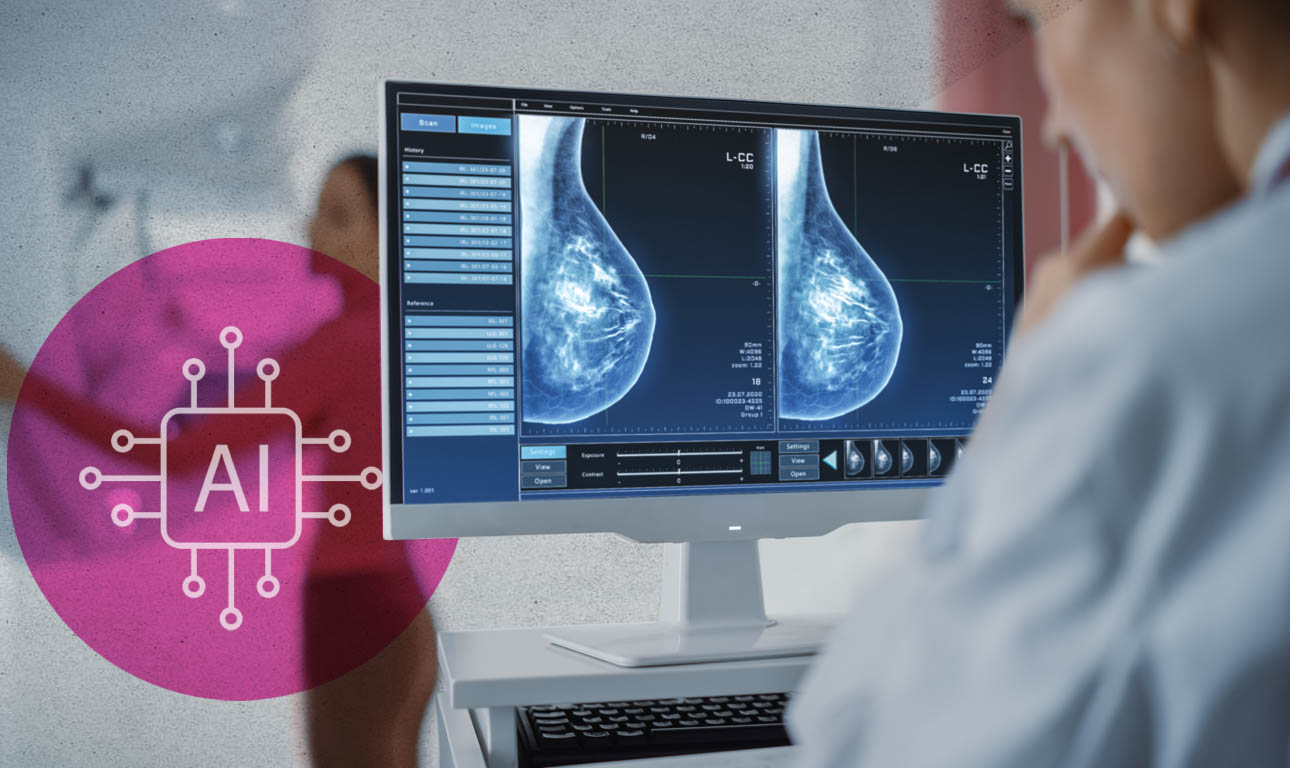 Μαστογραφία με ακτινολόγο ή από Τεχνητή Νοημοσύνη;