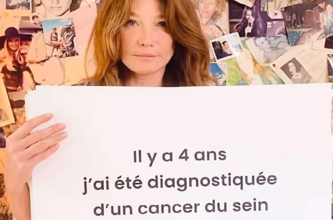 Κάρλα Μπρούνι: «Γυναίκες, κάντε μαστογραφία κάθε χρόνο!»