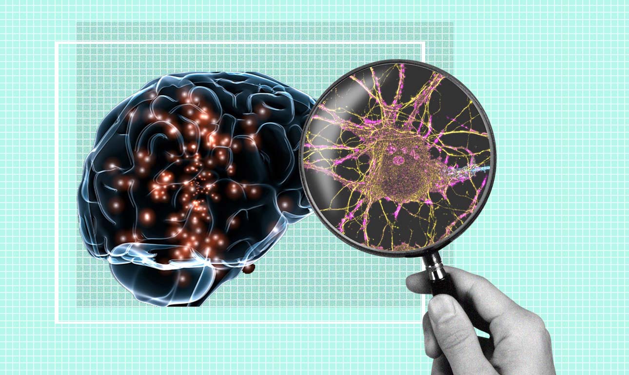 Ανοίγει το «μαύρο κουτί» του εγκεφάλου