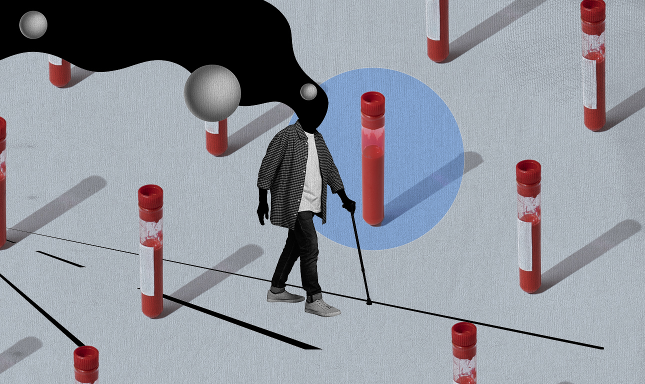 Πώς μια εξέταση αίματος θα ανιχνεύει την Αλτσχάιμερ