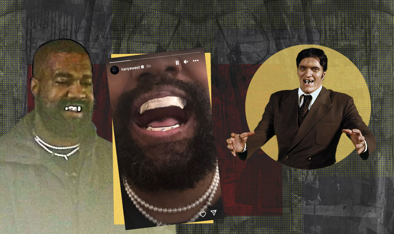 Υπερβολές που δαγκώνουν τη λογική: Ο Κάνιε Γουέστ έδωσε $850.000 για να μοιάσει στον «Σαγόνια» του 007