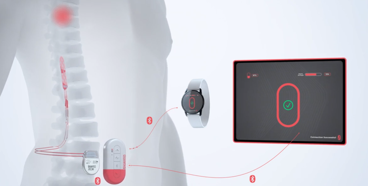 Μια συσκευή που τη φοράς και τα χέρια σου κουνιούνται