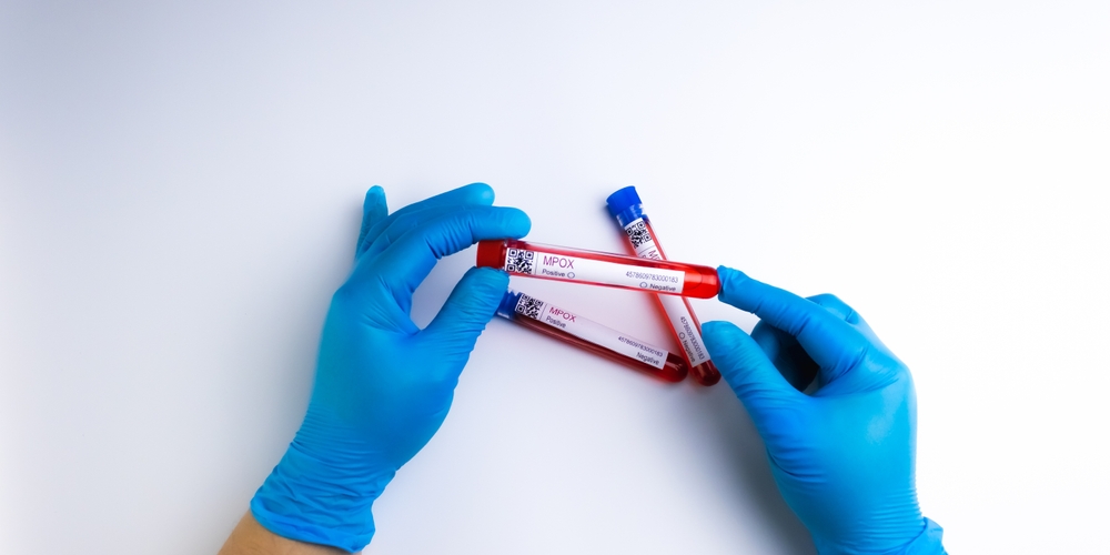 Mpox: Πόσο μας αφορά η νέα έξαρση – τι πρέπει να ξέρουμε για τον εμβολιασμό