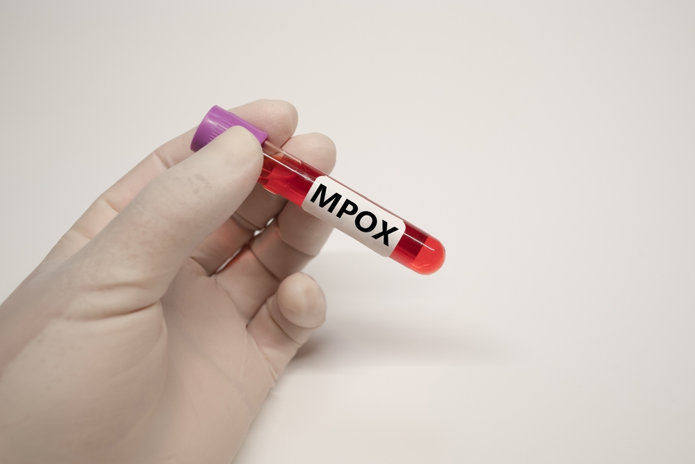 Πόσο πιθανό είναι να εξαπλωθεί η νέα Mpox στην Ευρώπη και την Ελλάδα