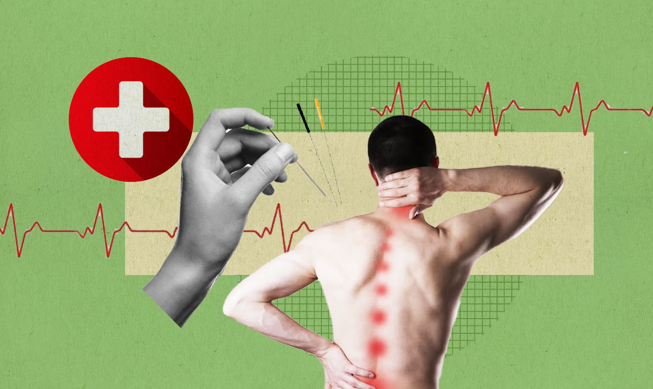 Βελονισμός στα Επείγοντα: Νέα δεδομένα στην ανακούφιση του πόνου