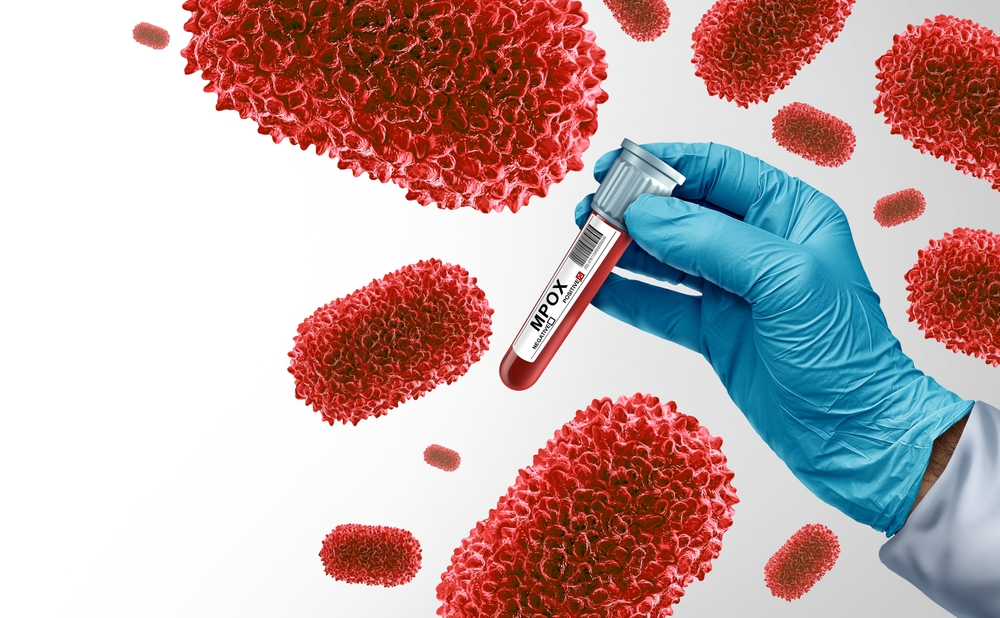 Αύξηση κρουσμάτων mpox στην Ελλάδα – τι συμβουλεύει ο ΕΟΔΥ