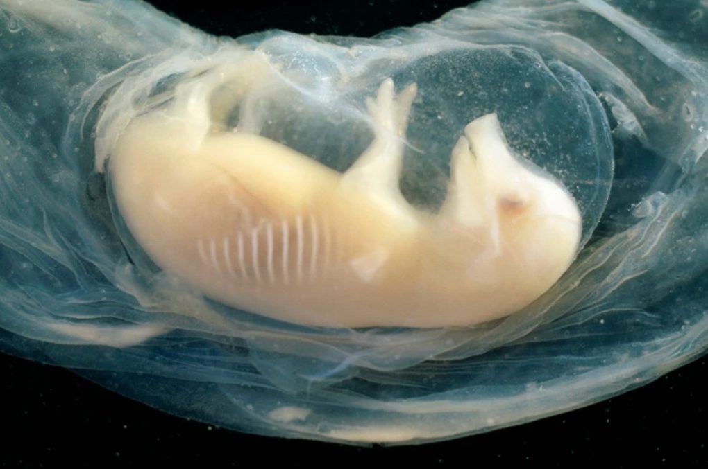 Για πρώτη φορά αναπτύχθηκε καρδιά με ανθρώπινα κύτταρα μέσα σε χοίρο