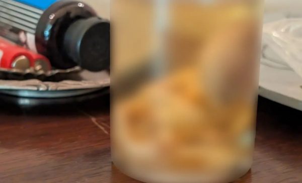 Φρίκη σε διαμέρισμα στην Αττική: Βρήκαν έμβρυο μέσα σε γυάλινη φιάλη